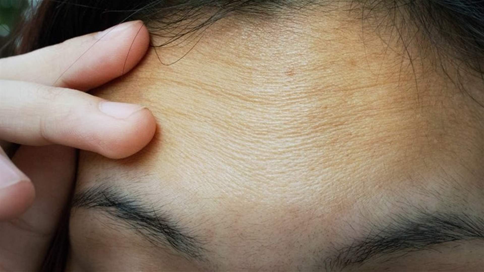 اتّبعوا هذه النصائح للتخلص من تجاعيد الجبين والوقاية منها