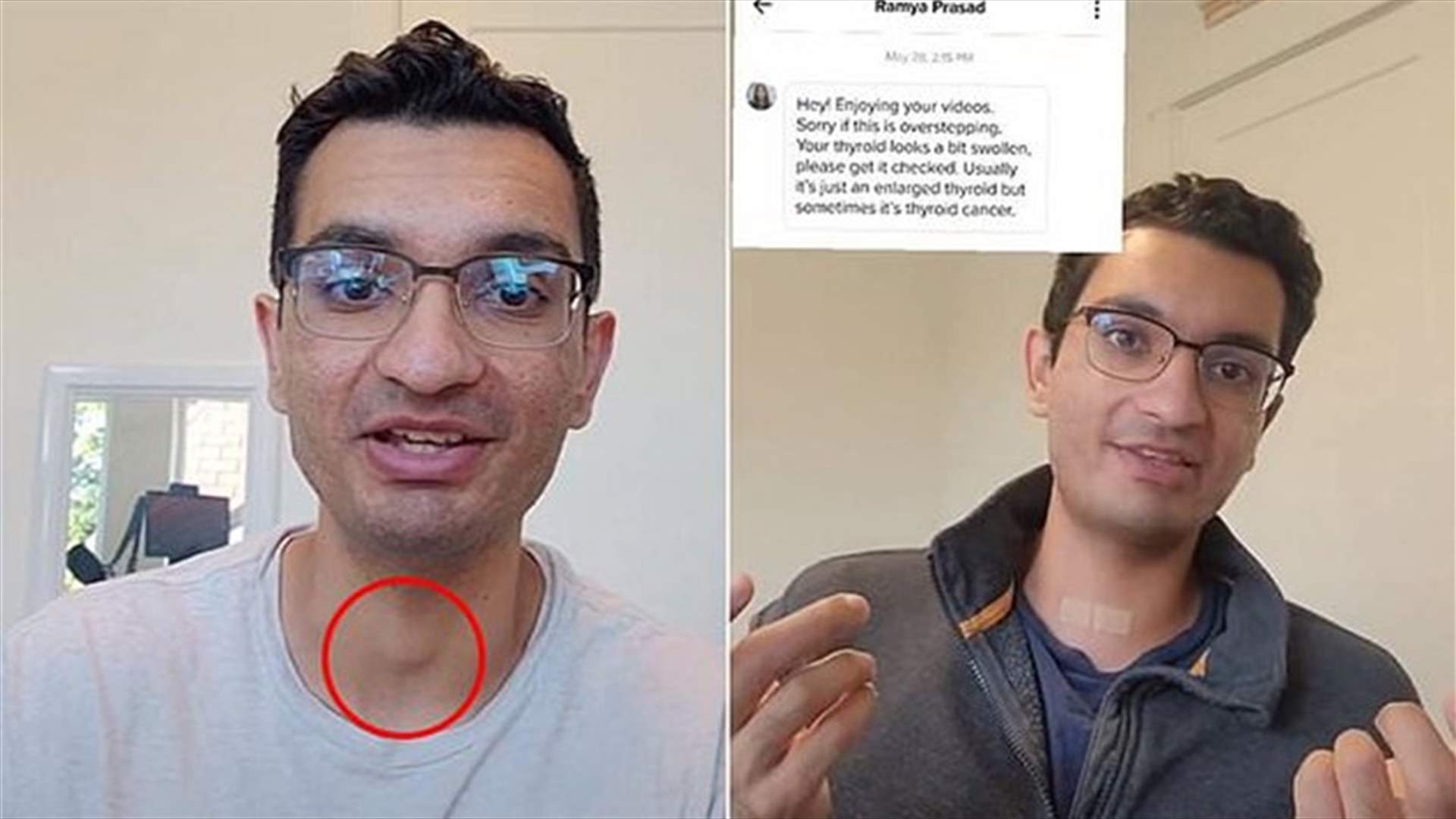 فيديو له على تيك توك كشف إصابته بسرطان الغدّة الدرقية... هذا ما حصل!
