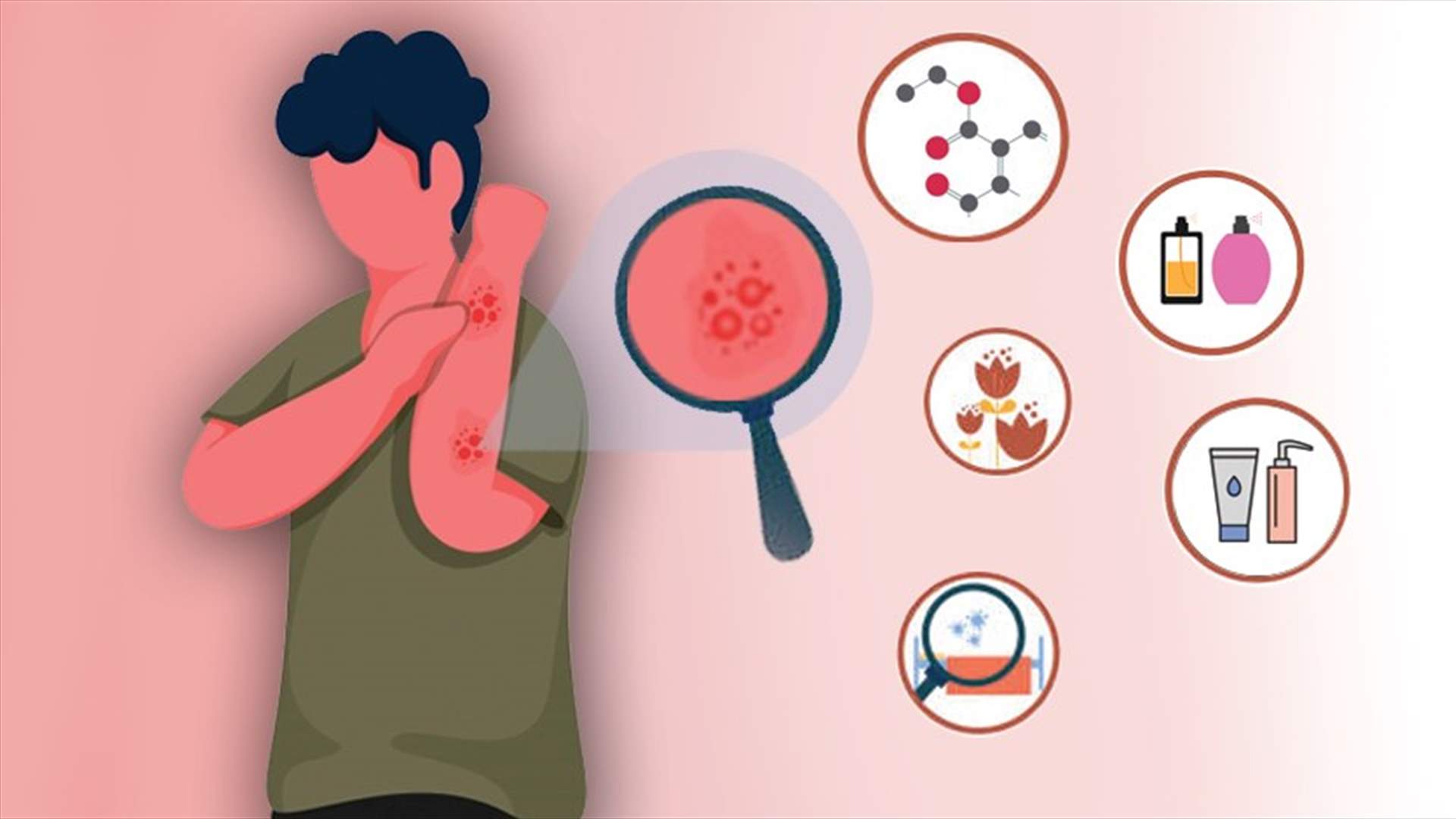 من الأسباب الى الأعراض وصولاً الى المضاعفات والوقاية... ماذا يقول الطب عن الإكزيما؟