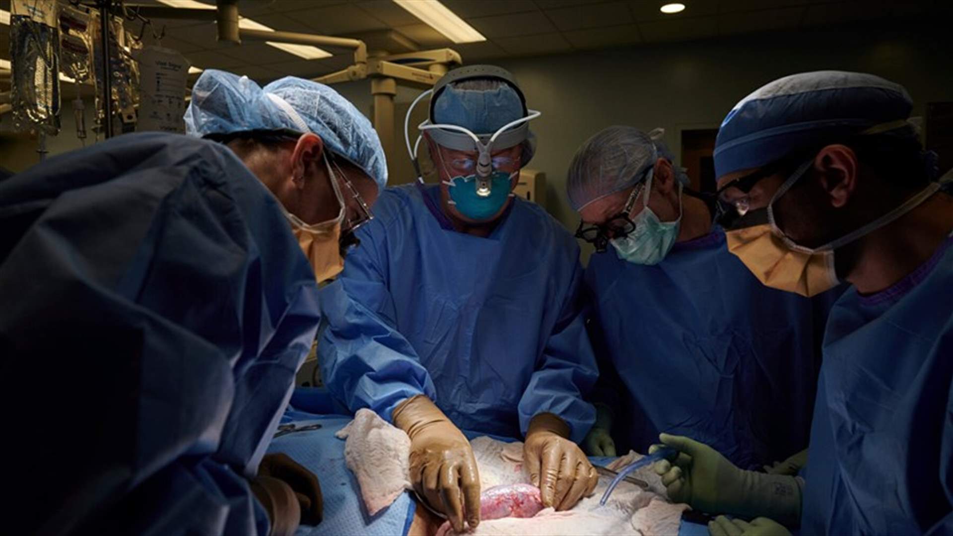 للمرة الأولى... أطباء أميركيون ينجحون في زرع كلية خنزير في جسم إنسان