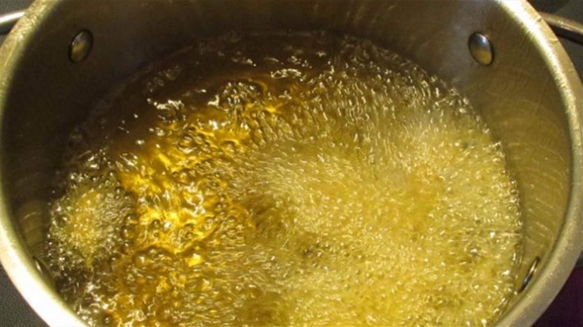 بعد 15 عاماً من الزواج... أردني يُحرق وجه زوجته وجسدها "بدون أي سبب"