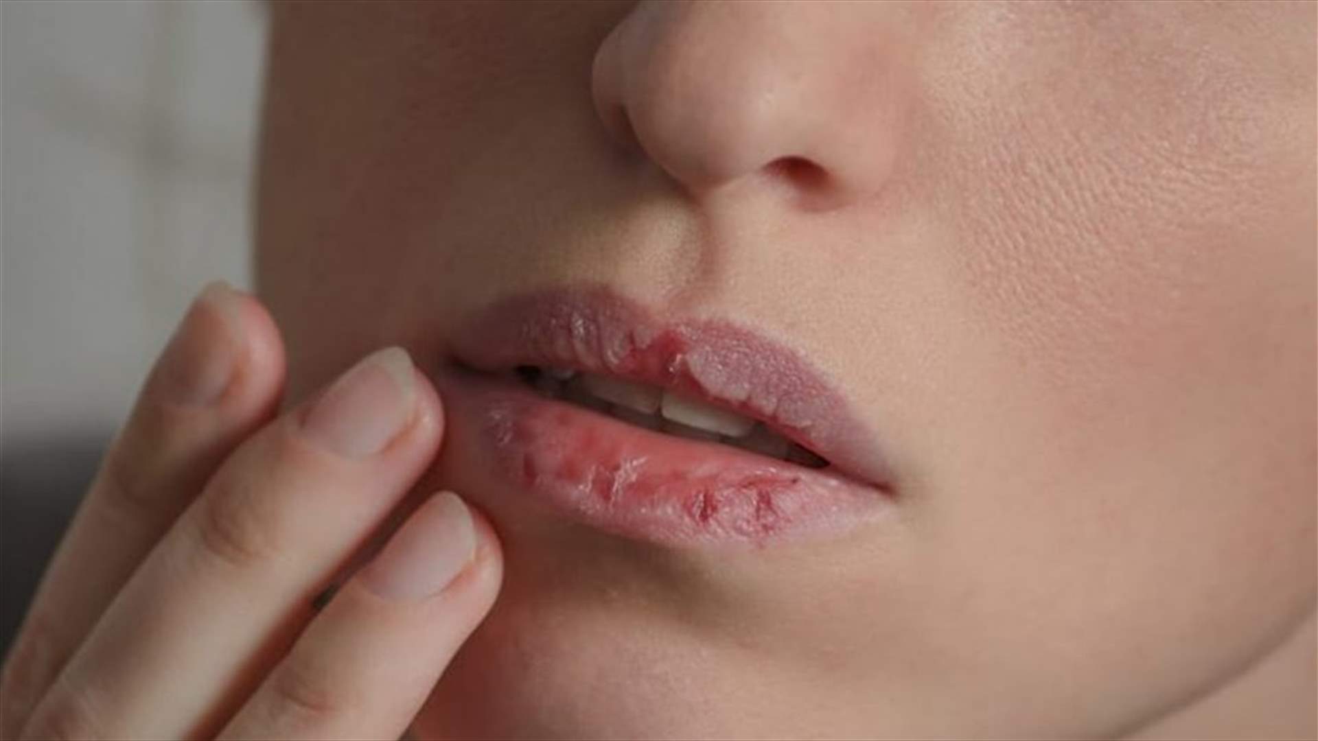 جفاف الفم في الصباح... ما هي أسبابه؟