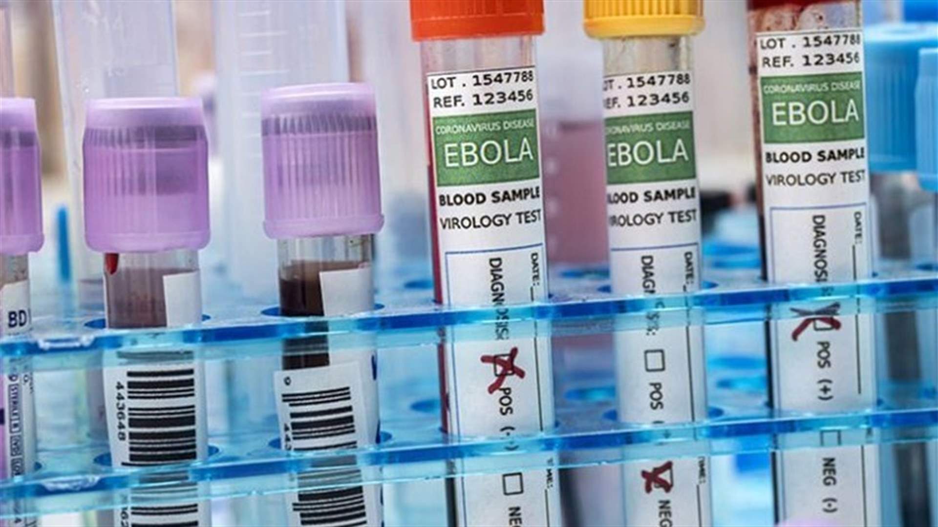 Oxford University team develops new Ebola vaccine