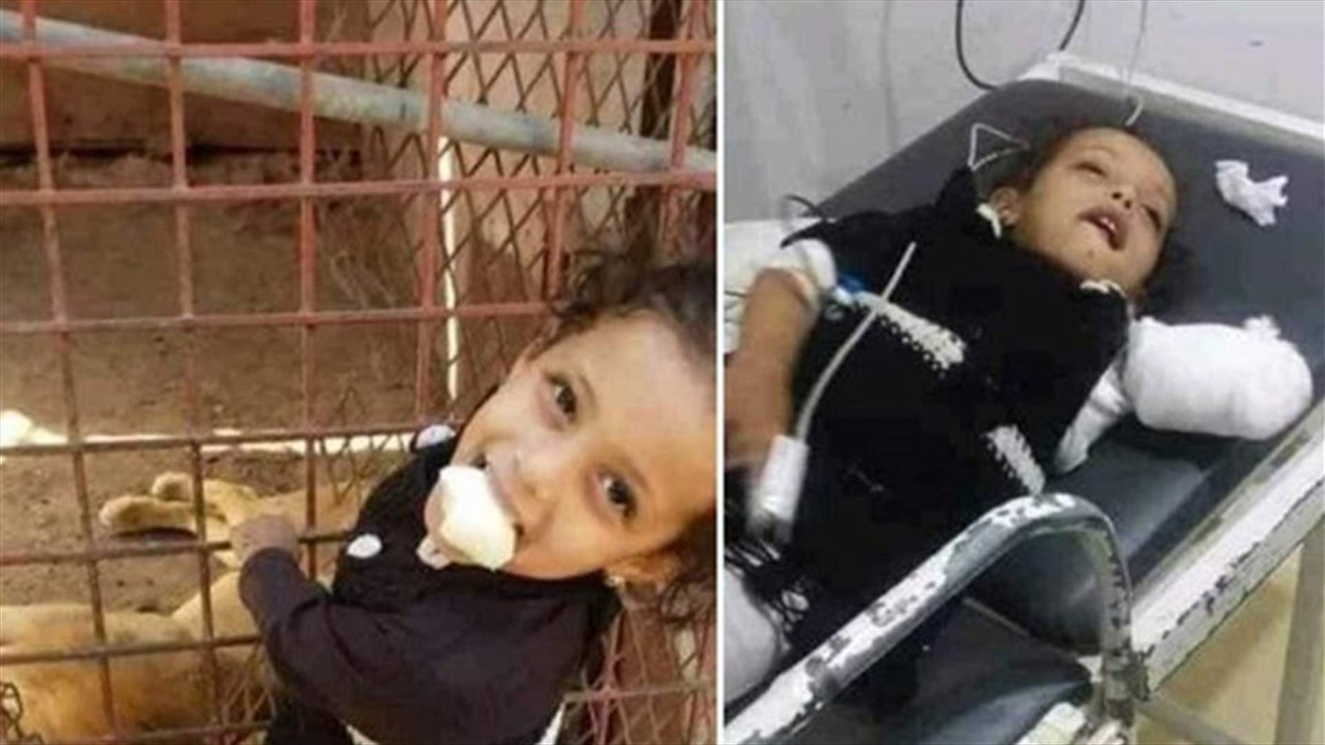 حادثة مؤلمة... أسد يلتهم يد طفلة في اليمن! (صورة)