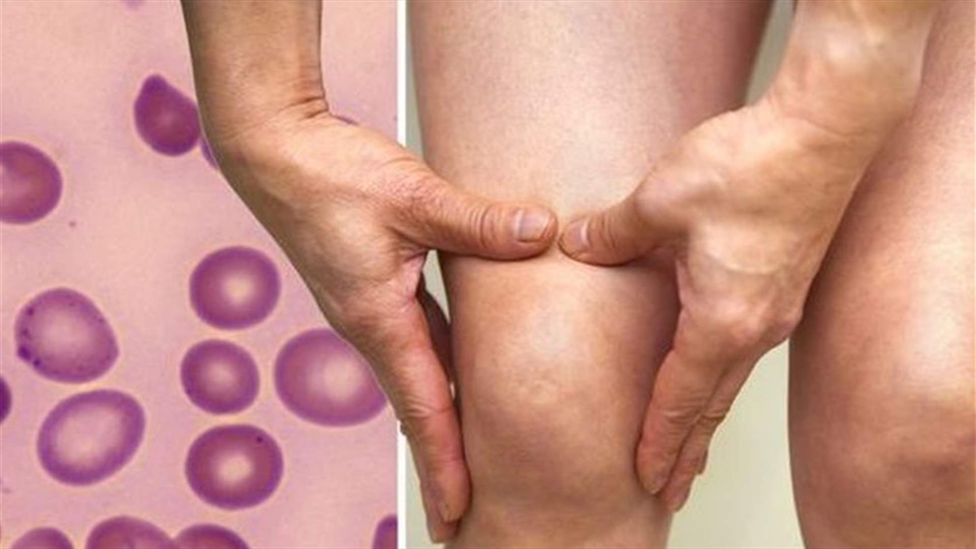 علامة قد تشعرون بها خلال الليل... تشير الى نقص الفيتامين B12!