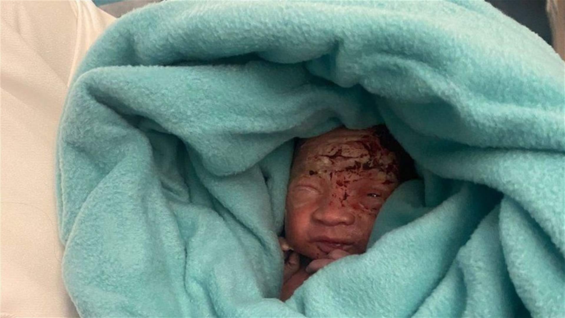 في موريشيوس... العثور على رضيعٍ حديث الولادة مرمي في حمام الطائرة
