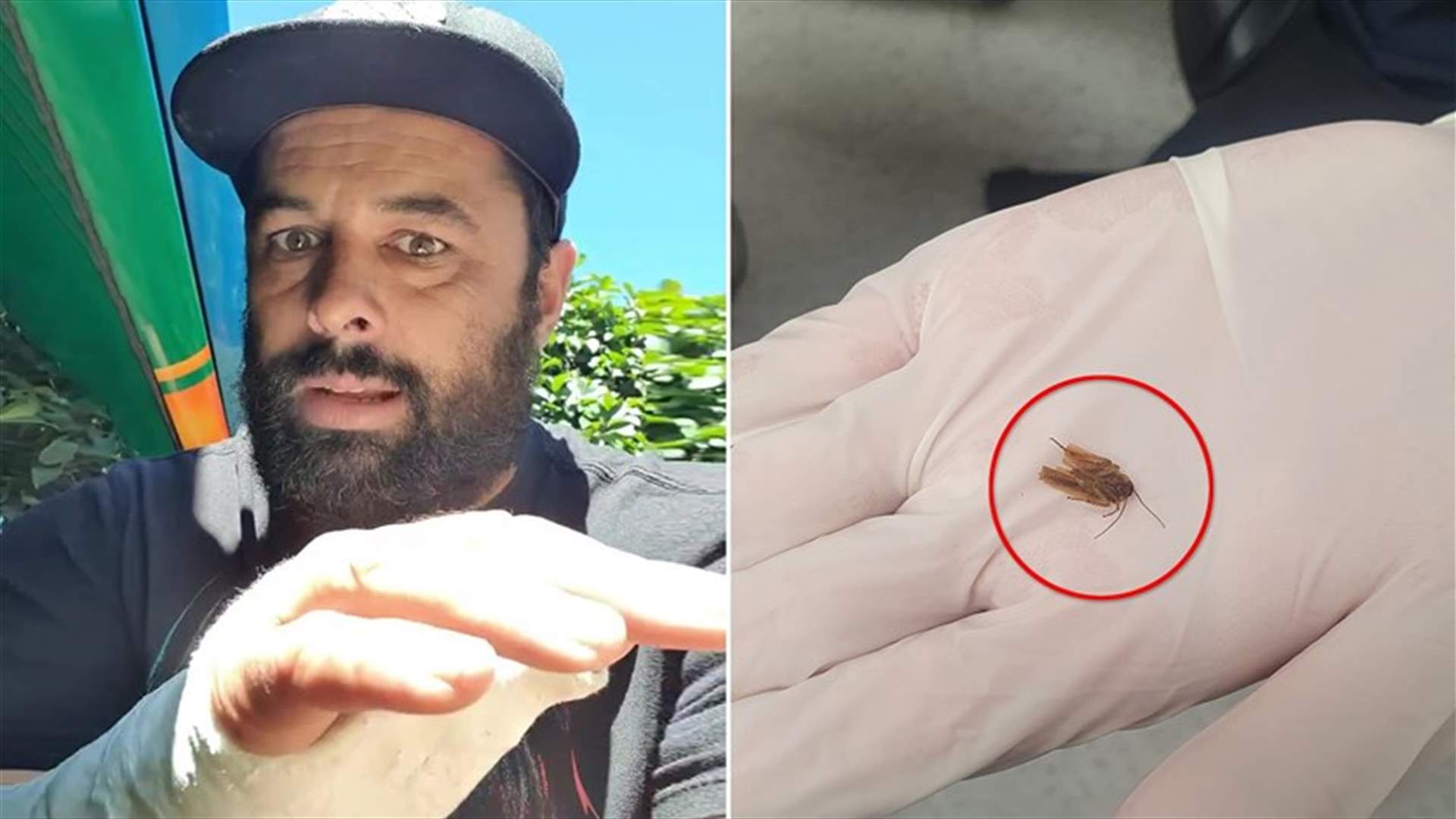 بعد 3 أيام من الآلام... هكذا خرج صرصور من أذن رجل نيوزيلندي (صورة)