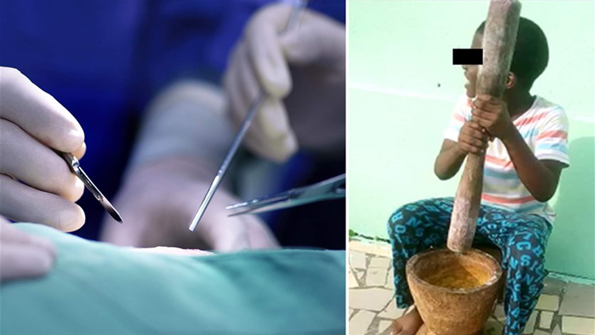 عن طريق الخطأ... طفل يقطع أعضاءه التناسلية أثناء إعداد الطعام!