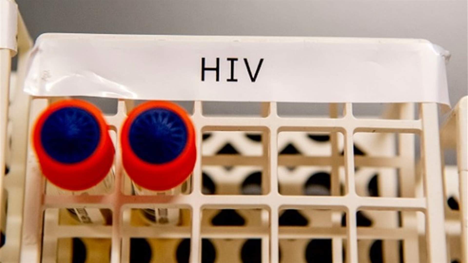 بعد زراعة خلايا جذعية ... شفاء أول امرأة من فيروس نقص المناعة البشرية