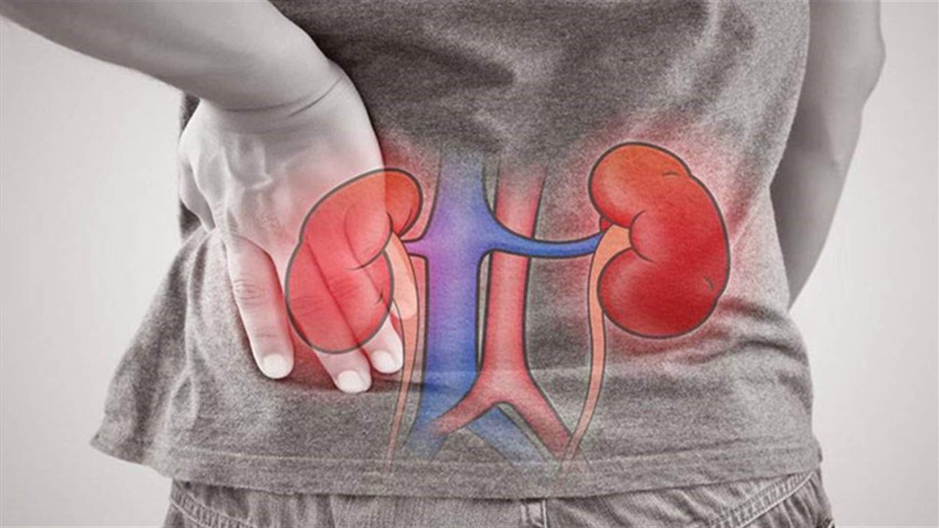 الفشل الكلوي الحاد... ما هي أعراضه؟