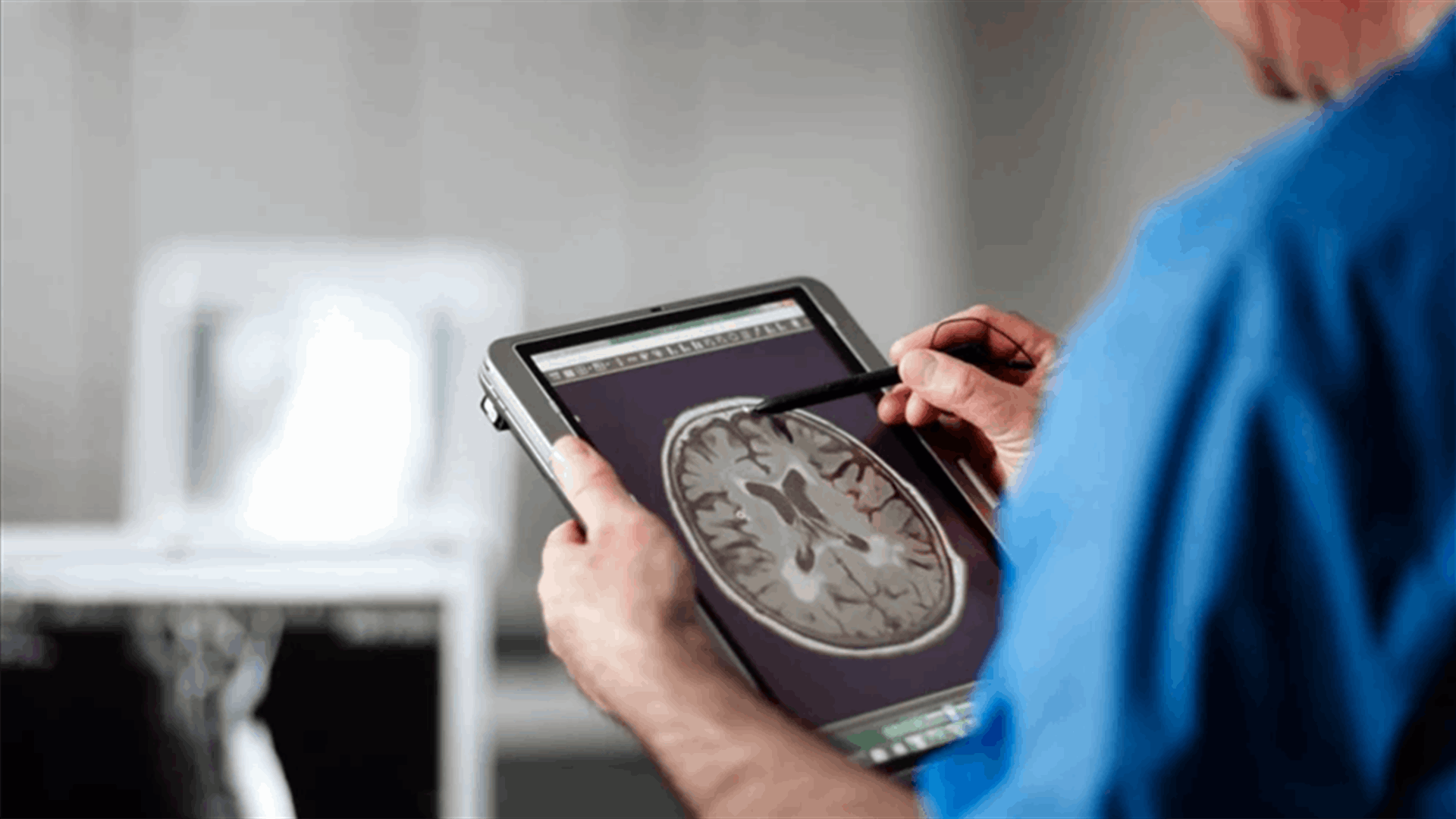 COVID-19 can cause brain shrinkage, memory loss - study