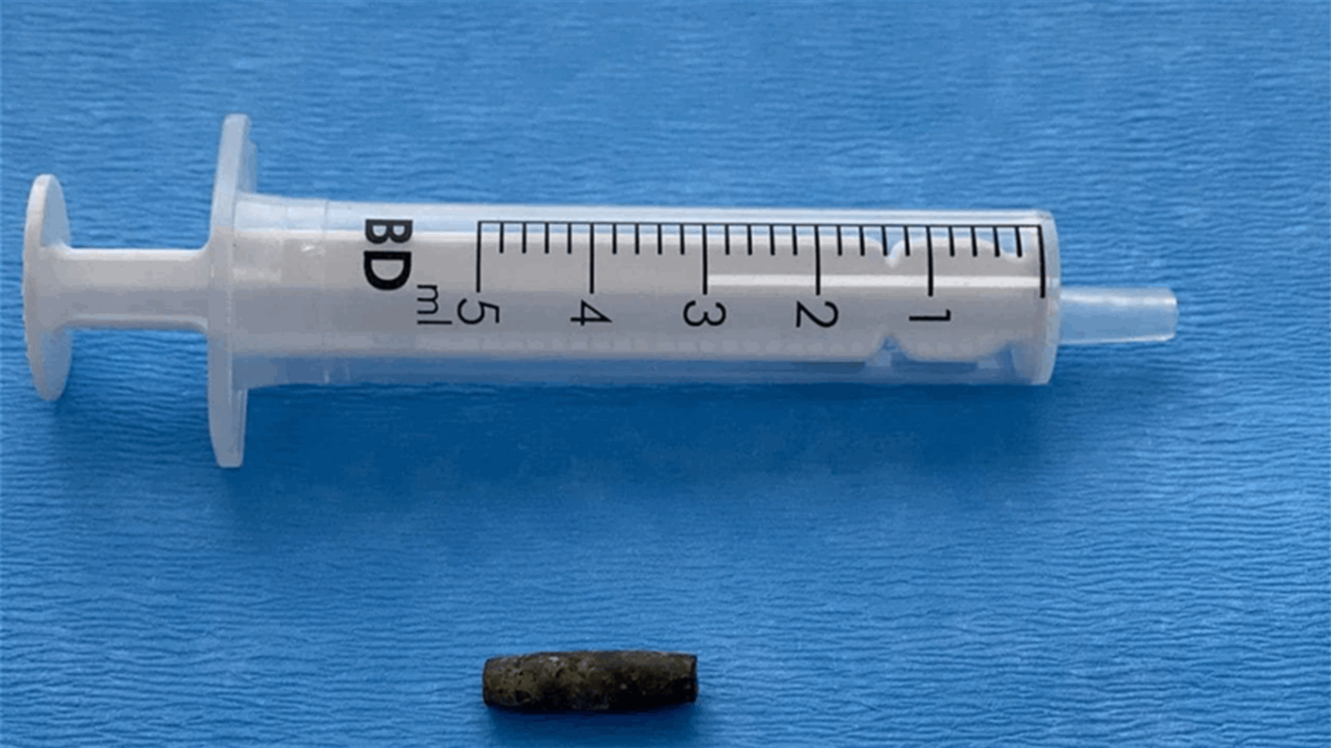Moment surgeons remove bullet from Ukrainian soldier heart-[VIDEO]