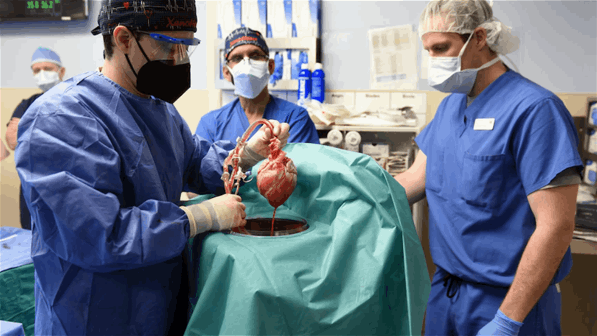علماء يكشفون... العثور على فيروس في قلب الخنزير الذي زُرع لرجل مريض