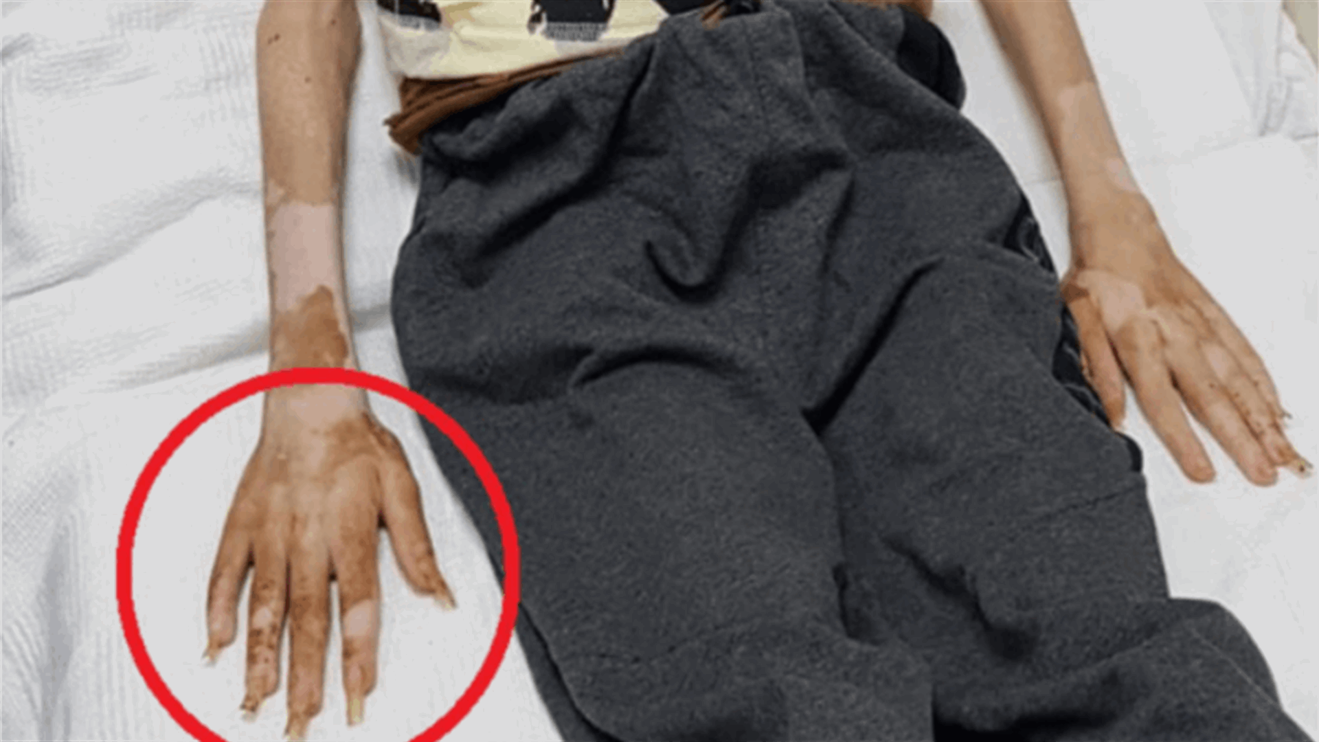 العثور على طفل في غرفة مكتظة بالنفايات... حبسته خالته داخلها!