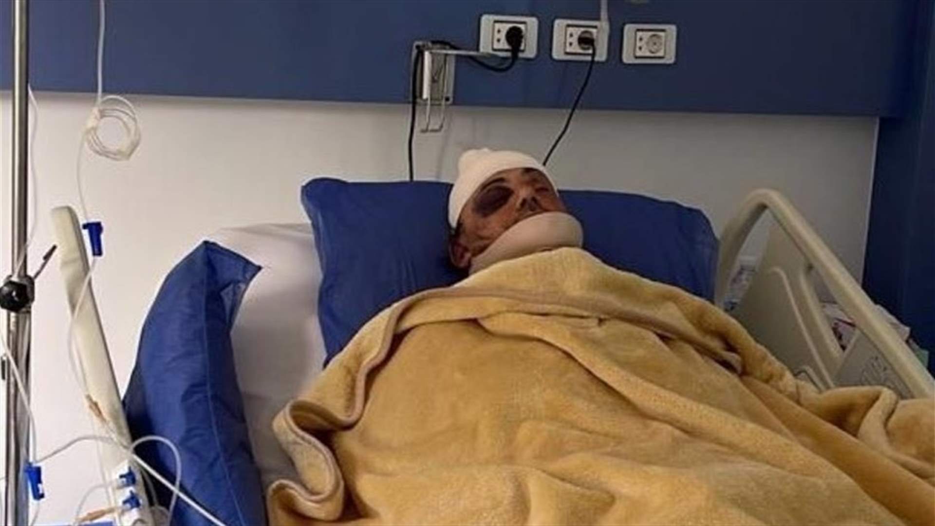 سمير صفير بعد تعرّضه لكسر في الجمجمة: لا أذكر ما حصل معي!