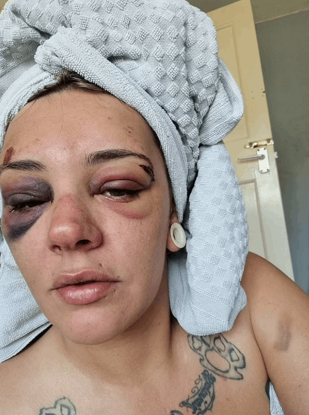 كتبت اسمه بدمها على الحائط حتى لا ينجو بفعلته... قصة حب انتهت بشكل مرعب وهذه تفاصيلها! (صور)