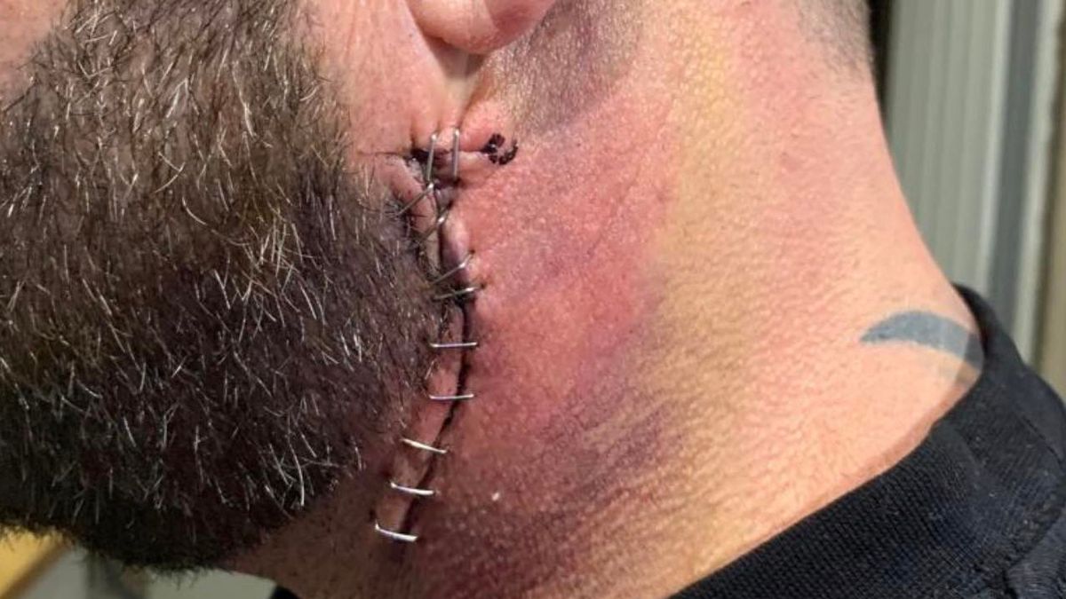 كاد أن يموت بسبب طعنة سكين في رقبته... لن تتخيلوا السبب وراء نجاة هذا الرجل المحظوظ ! (صور)