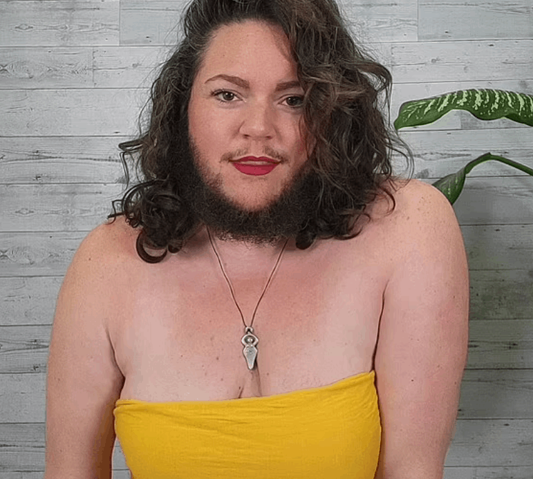 بدأت لحيتي تنمو عندما كنت مراهقة ووصفني الناس بأبشع الكلمات ... شابة تروي رحلة كفاحها مع شعر الوجه وهذه مشكلتها! (صور)