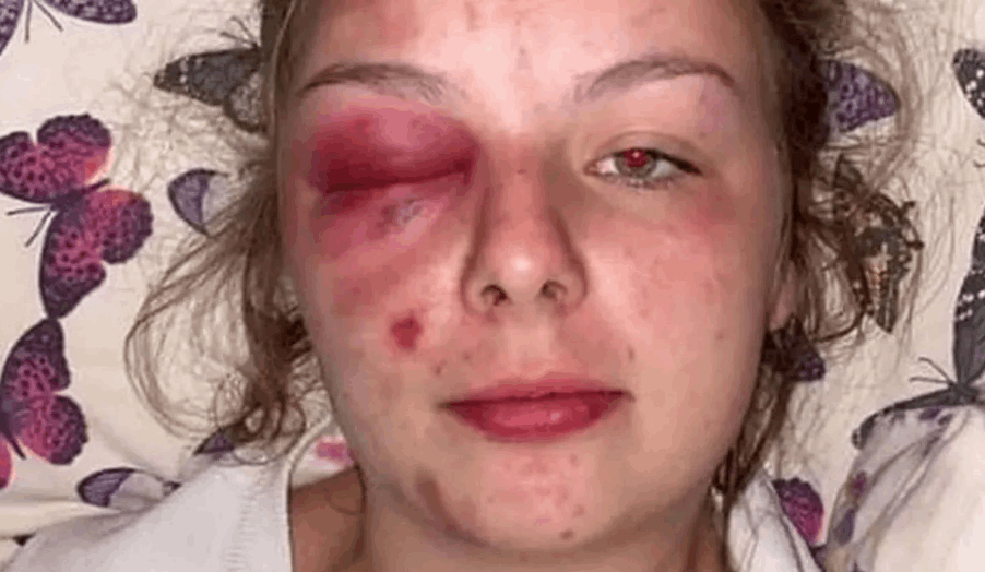 ادعت أن مجموعة رجال ضربوها واغتصبوها... الحقيقة التي ظهرت في النهاية صدمت الجميع: لن تصدقوا هوية الفاعل! (صور)