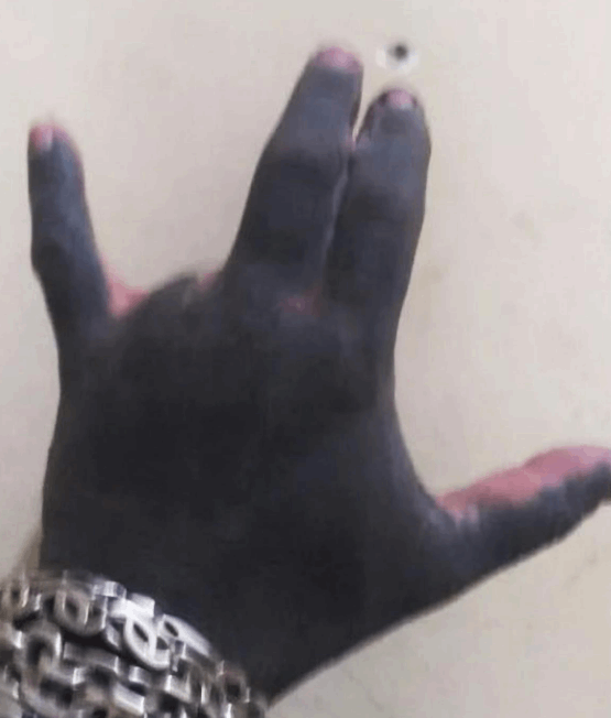 هل تعرفون الشيطان البشري ؟... أزال أذنيه وأنفه وحلمتيه وبتر 3 أصابع للحصول على مخالب شيطانية! (فيديو)