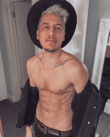 رجل عابر جنسيا يخطط لإنشاء عائلة مع خطيبته... رحلة طويلة هدفها تحقيق حلم إنجاب طفل (صور)