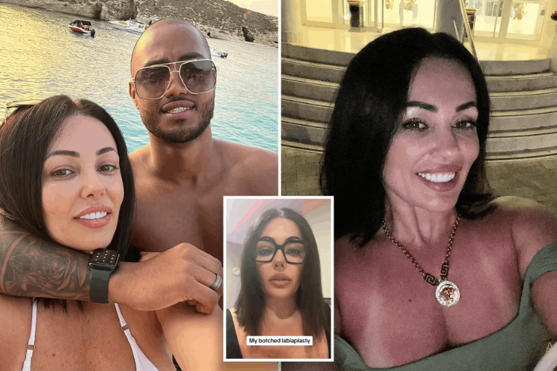 تعليقات أحبائها السابقين دفعتها للقيام بالخطوة... سيدة تخضع لعملية تجميل المهبل وهذا ما حصل لها!