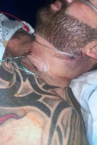 كاد أن يموت بسبب طعنة سكين في رقبته... لن تتخيلوا السبب وراء نجاة هذا الرجل المحظوظ ! (صور)