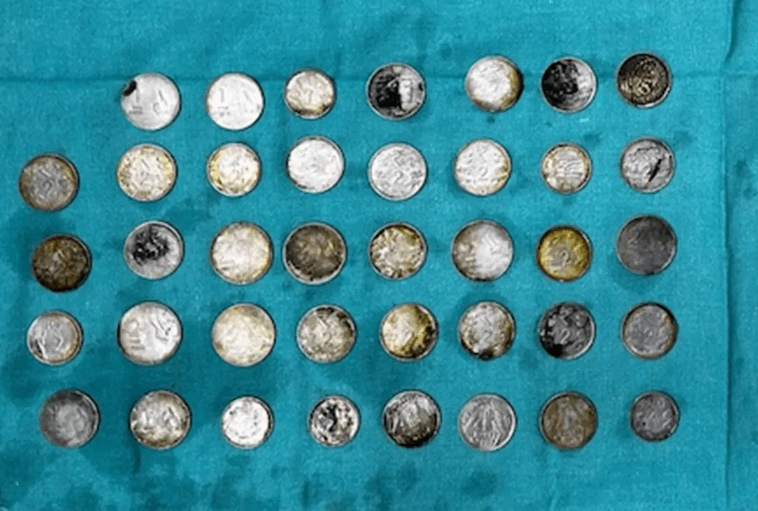 لسبب غريب جدا... رافع أثقال أكل 39 عملة معدنية و37 مغناطيسا وهذا مصيره! (صور)