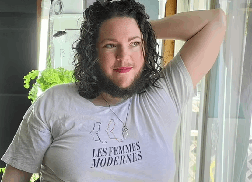 بدأت لحيتي تنمو عندما كنت مراهقة ووصفني الناس بأبشع الكلمات ... شابة تروي رحلة كفاحها مع شعر الوجه وهذه مشكلتها! (صور)