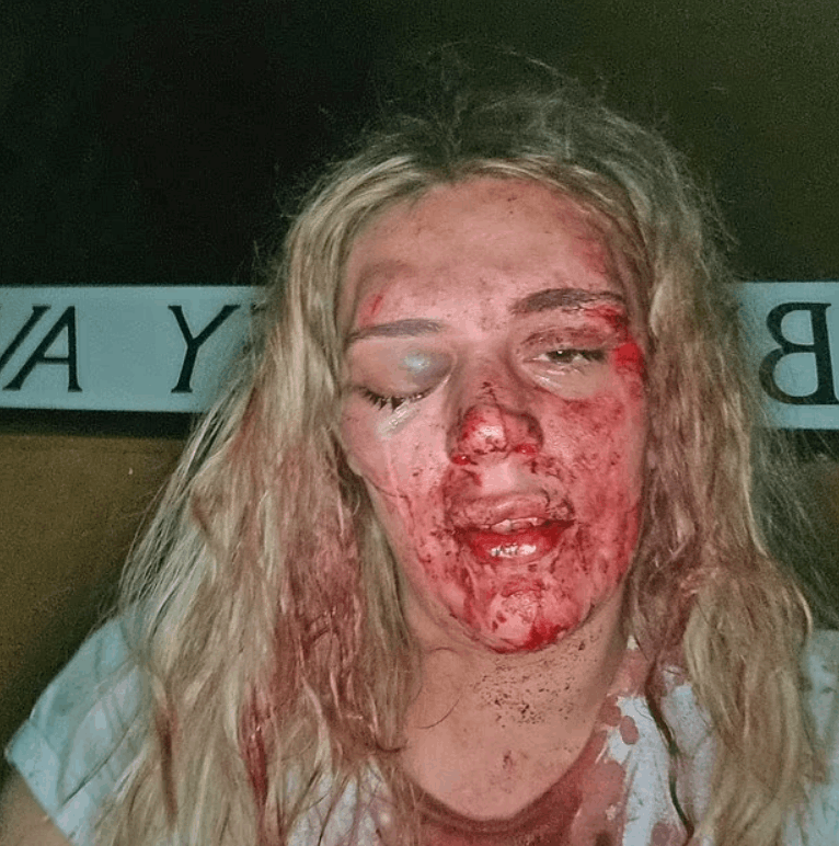 كتبت اسمه بدمها على الحائط حتى لا ينجو بفعلته... قصة حب انتهت بشكل مرعب وهذه تفاصيلها! (صور)