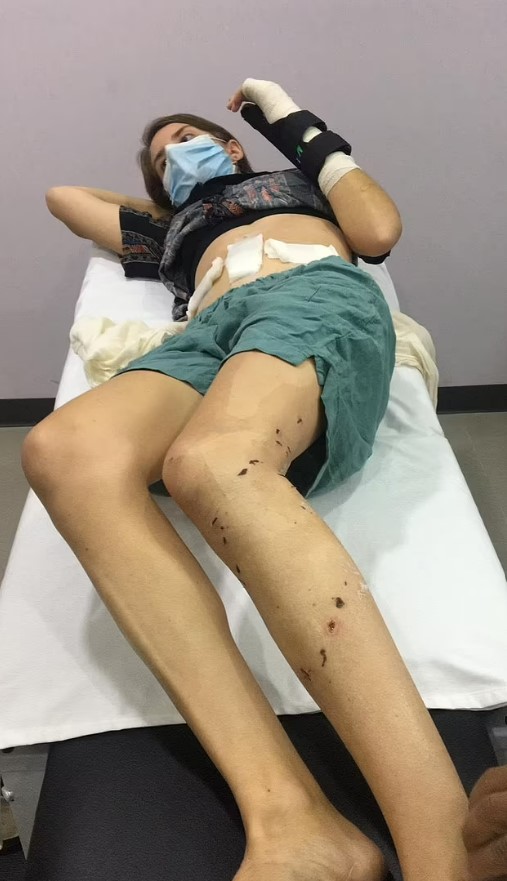 أنقذت شقيقتها التوأم من هجوم تمساح... الملك تشارلز يقدم وسام ملكي للشابة البطلة (صور)