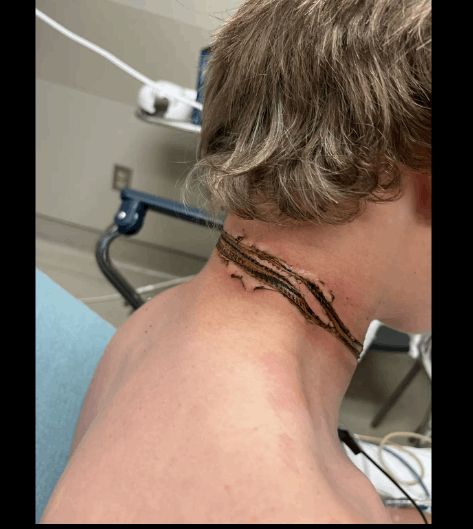 قلادته كادت أن تقتله... أراد التأكد من شحن هاتفه ولكن ما حصل بعدها مرعب: رأيت الشرارات تخرج من رقبتي ! (صور)