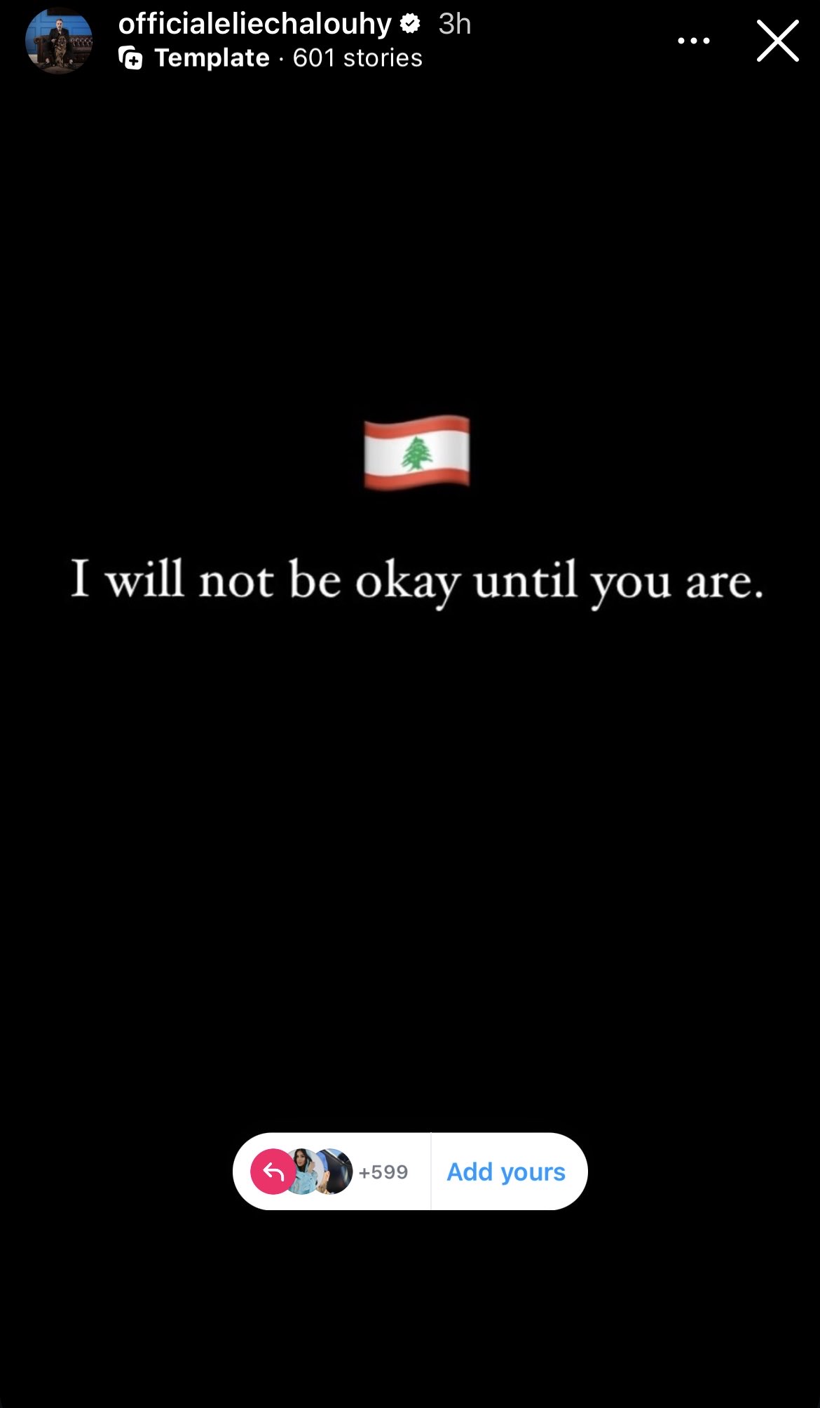 إيلي شالوحي يعبر عن وجعه: لن أكون بخير حتى يكون لبنان بخير (صورة)