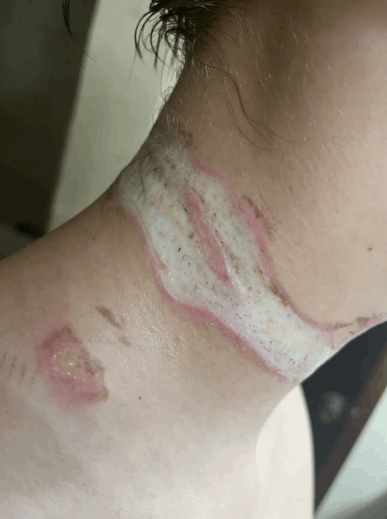 قلادته كادت أن تقتله... أراد التأكد من شحن هاتفه ولكن ما حصل بعدها مرعب: رأيت الشرارات تخرج من رقبتي ! (صور)