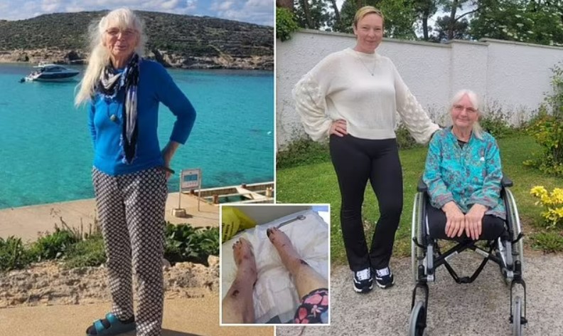 مسنة فقدت ساقيها... بسبب لدغة بعوض ! (صورة)