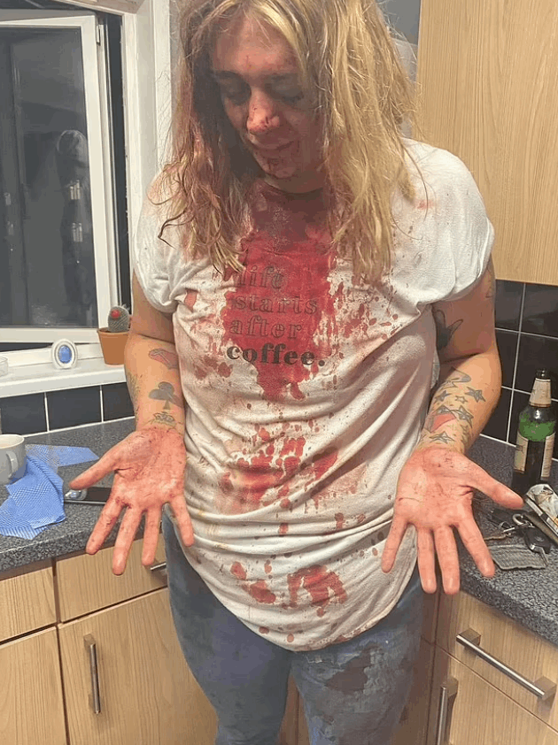 كتبت اسمه بدمها على الحائط حتى لا ينجو بفعلته... قصة حب انتهت بشكل مرعب وهذه تفاصيلها! (صور)