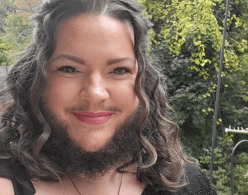 بدأت لحيتي تنمو عندما كنت مراهقة ووصفني الناس بأبشع الكلمات ... شابة تروي رحلة كفاحها مع شعر الوجه وهذه مشكلتها! (صور)