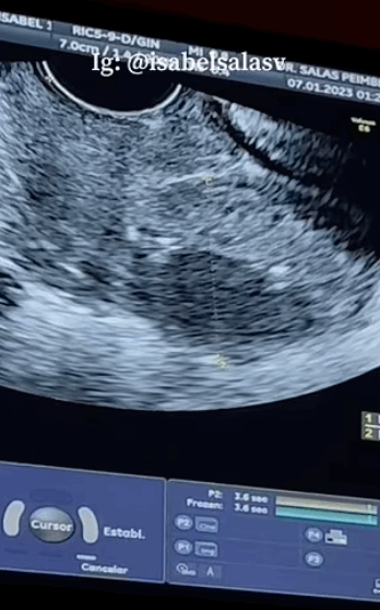 مؤثرة تصدم متابعيها: أخضع كل شهرين لاختبار الحوض... ووالدي هو الطبيب ! (صور)