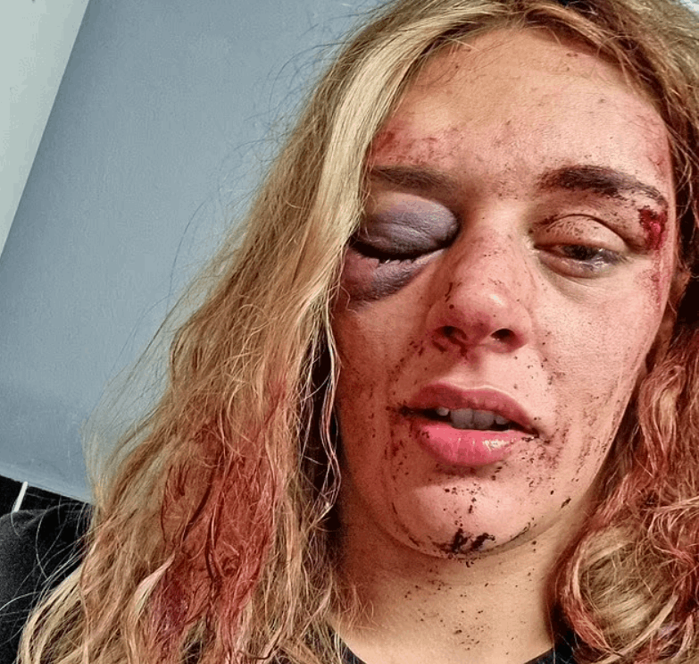 كتبت اسمه بدمها على الحائط حتى لا ينجو بفعلته... قصة حب انتهت بشكل مرعب وهذه تفاصيلها! (صور)