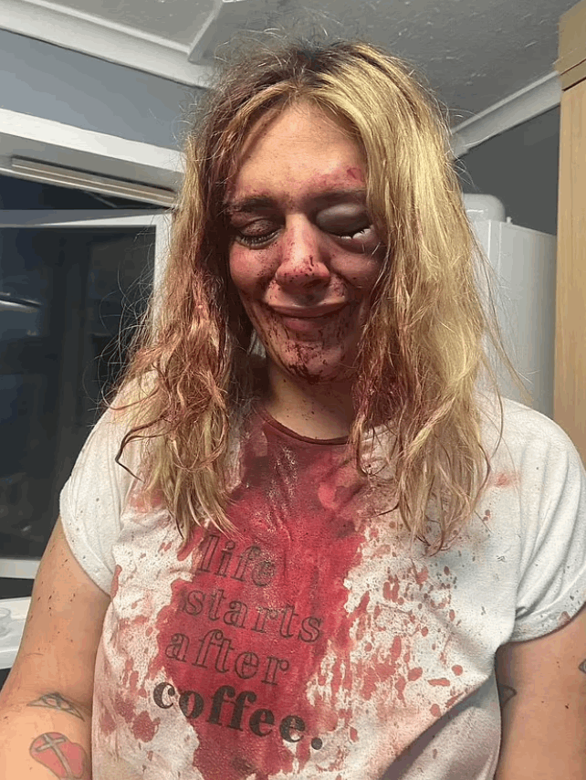 كتبت اسمه بدمها على الحائط حتى لا ينجو بفعلته... قصة حب انتهت بشكل مرعب وهذه تفاصيلها! (صور)