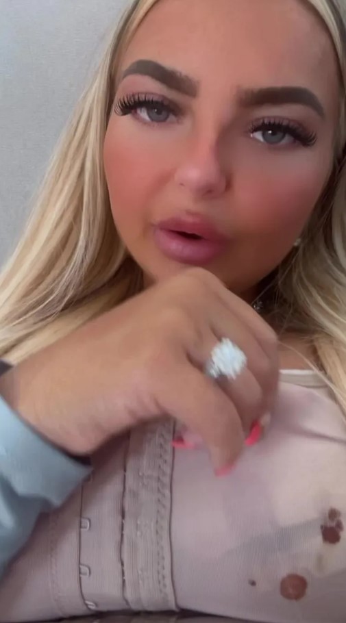 عارضة أزياء تعيش كابوسا... أجرت عملية جراحية لجسمها في تركيا وهذا ما حدث! (صور)