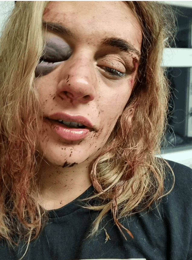 كتبت اسمه بدمها على الحائط حتى لا ينجو بفعلته... قصة حب انتهت بشكل مرعب وهذه تفاصيلها! (صور)