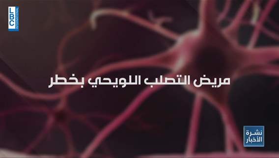 Sclerosis can cause damage to the brain and patients in Lebanon are at risk